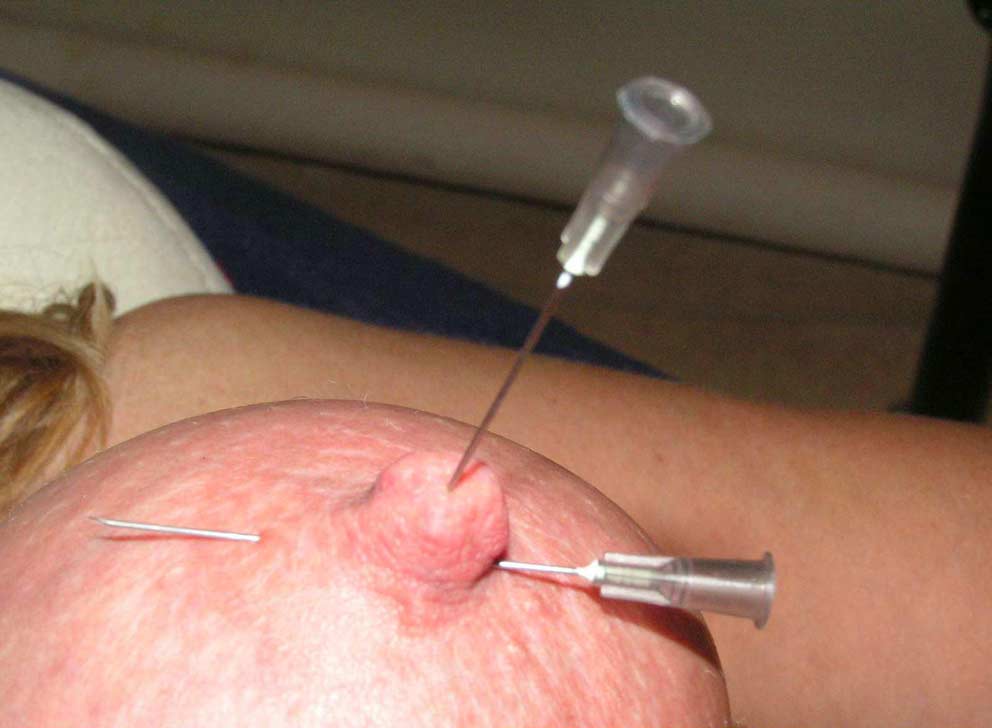 Needle torture gallery.